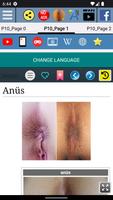 Anüs Anatomisi Ekran Görüntüsü 1