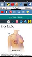 Brustkrebs Screenshot 1