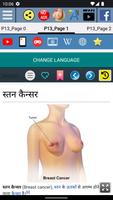 स्तन कैन्सर स्क्रीनशॉट 1