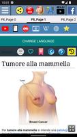 1 Schermata Tumore alla mammella