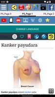 Kanker payudara screenshot 1
