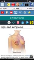 Breast Cancer ภาพหน้าจอ 1