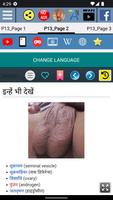 वृषण - शारीरिकी स्क्रीनशॉट 2