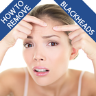 How To Remove Blackheads আইকন