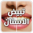 Teeth whitening at home