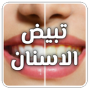 Teeth whitening at home APK