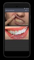 Teeth whitening at home poster