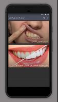 Teeth whitening at home screenshot 1