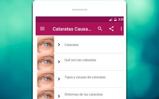 Cataratas Causas, síntomas y tratamiento syot layar 3