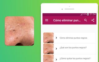 Cómo eliminar puntos negros Screenshot 2