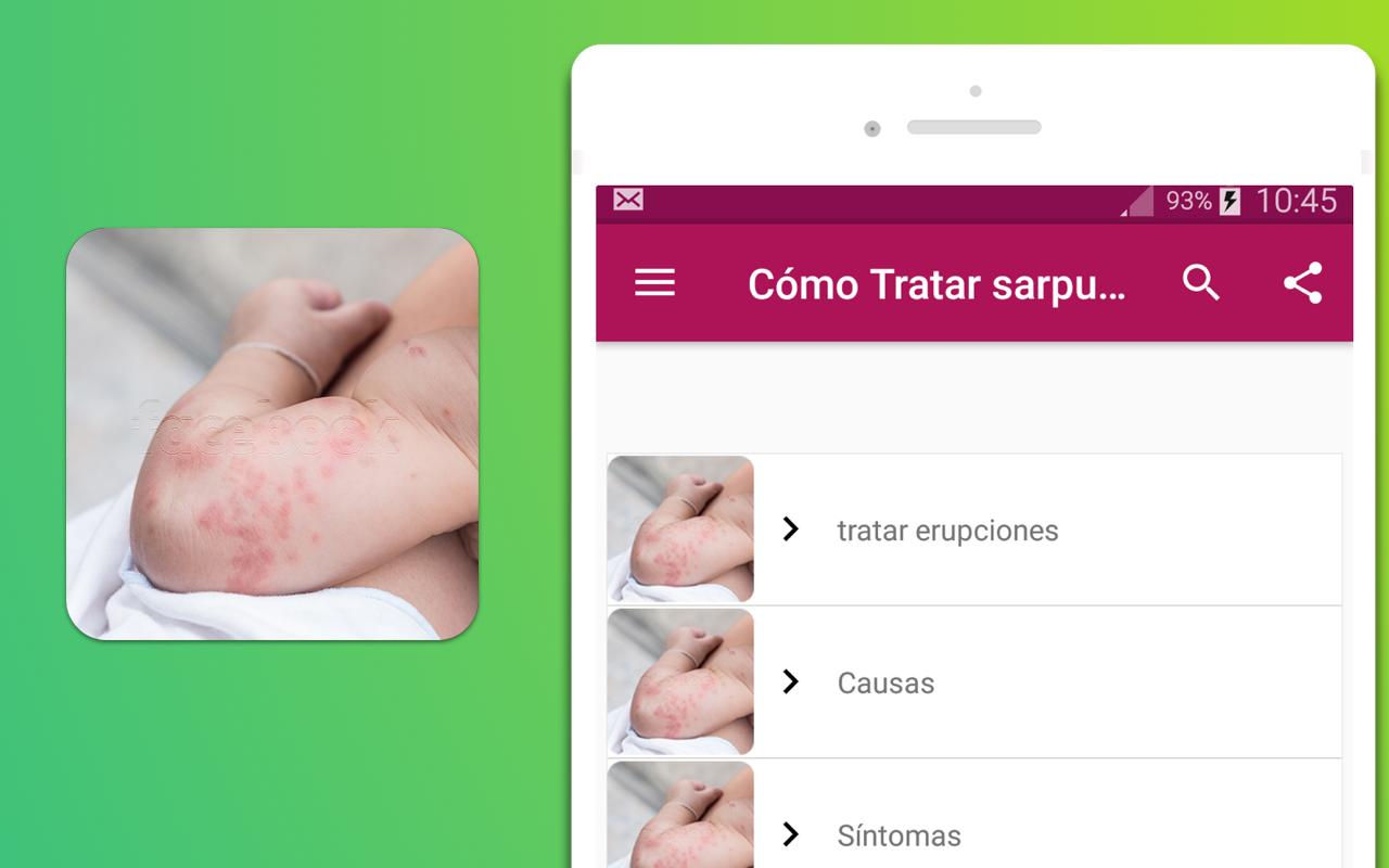cómo tratar sarpullidos en