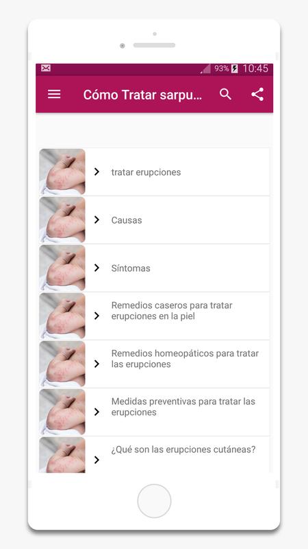 cómo tratar sarpullidos en