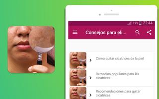 Consejos para eliminar las cicatrices screenshot 3