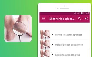 remedios para eliminar los talones agrietados اسکرین شاٹ 3