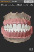 BoneBox™ - Dental Lite Plakat