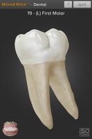 BoneBox™ - Dental Lite تصوير الشاشة 2