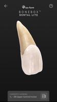 2 Schermata BoneBox™ - Dental Lite