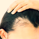 طرق علاج تساقط الشعر APK
