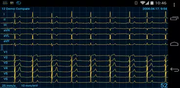 Cardiax Mobile EKG