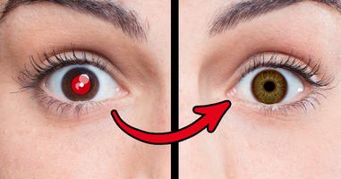 Red Eye Removal - Remove Red Eye Affiche