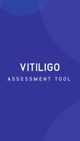 Vitiligo 포스터