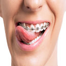 Cleaning Tips with Braces APK