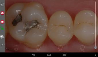 Poster iOralCam Intraoral Camera App