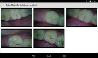 iOralCam Intraoralkamera App Screenshot 1