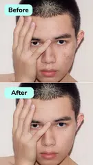 瑕疵清除器 XAPK 下載