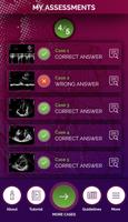 EchoRight syot layar 3