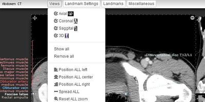 Imaging Anatomy - CT MRI XR US Affiche