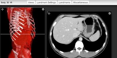 Imaging Anatomy - CT MRI XR US скриншот 1