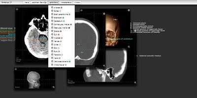 Imaging Anatomy - CT MRI XR US Screenshot 2