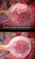 3D生理和病理学 screenshot 2