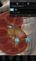 3D生理和病理学 screenshot 3