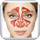 علاج الجيوب الأنفية في المنزل APK