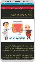 علاج البواسير في المنزل Ekran Görüntüsü 1