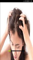 وصفات مختلفة لعلاج قشرة الشعر Affiche