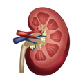 1 Kidney Transplant