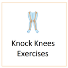 Knock Knees Exercises ícone