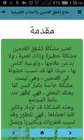 علاج تشقق القدمين بالاعشاب الطبيعية captura de pantalla 2