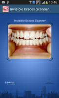 Invisible Braces Scan Affiche