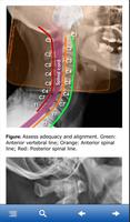 Advanced Trauma Life Support ภาพหน้าจอ 1