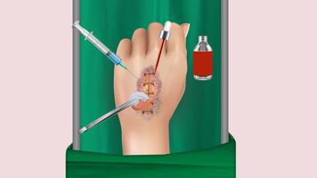 trò chơi bác sĩ phẫu thuật bện ảnh chụp màn hình 1
