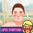 Lupus Symptoms