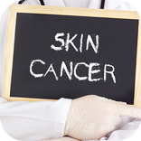皮膚ガン