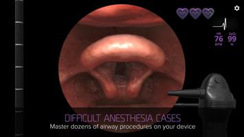 Airway Ex تصوير الشاشة 1