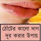 ঠোঁটের কালো দাগ দূর করার উপায়-icoon