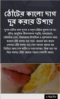 ঠোঁটের কালো দাগ দূর করার উপায় Affiche