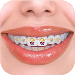 ブレースフォトエディタ2019